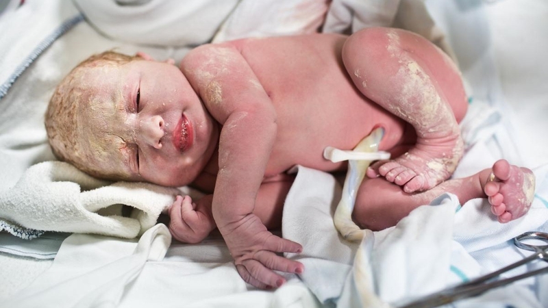 Dấu hiệu bé sắp rụng rốn mẹ bỉm nào cũng cần biết 1