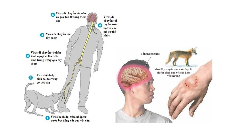 dấu hiệu bệnh dại ở người 1