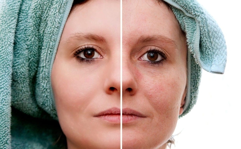 Dấu hiệu bệnh dị ứng thời tiết và cách điều trị 1