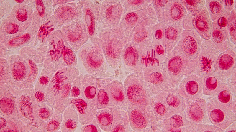 Nên thực hiện xét nghiệm khi có các biểu hiện nghi ngờ như tiểu buốt, chảy dịch bất thường