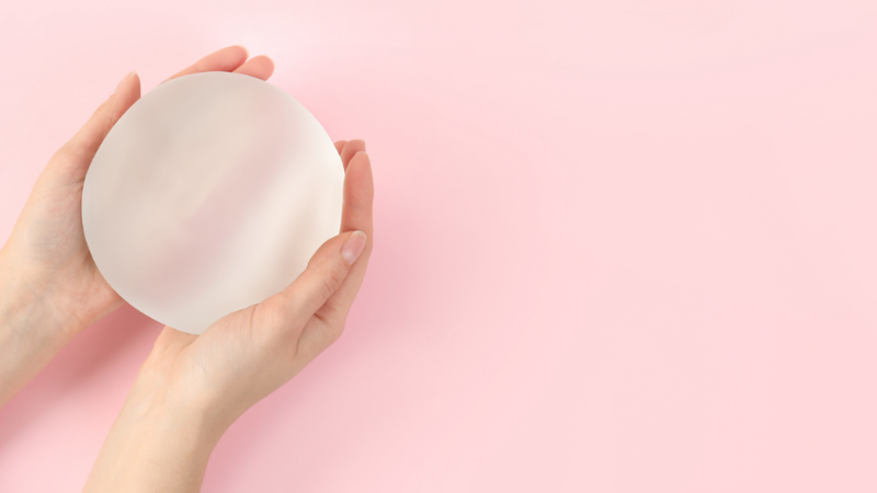 Dấu hiệu bị bao xơ sau nâng ngực cấp độ 4 bao gồm ngực cứng, đau và biến dạng rõ rệt