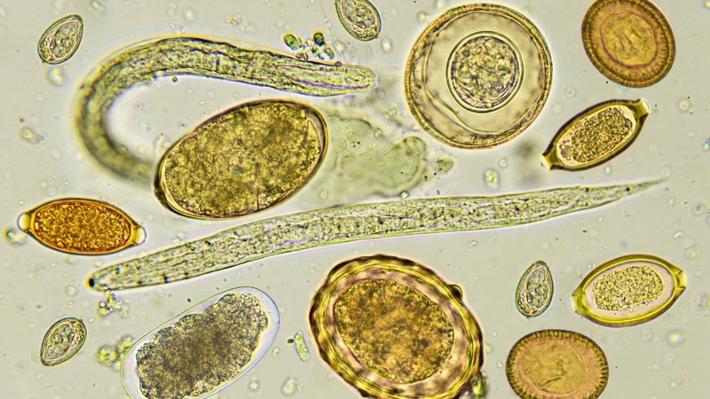 Dấu hiệu bị giun sán ở người lớn cần đề cao cảnh giác 1