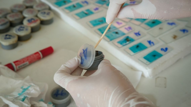 Dấu hiệu bị giun sán ở người lớn cần đề cao cảnh giác 3