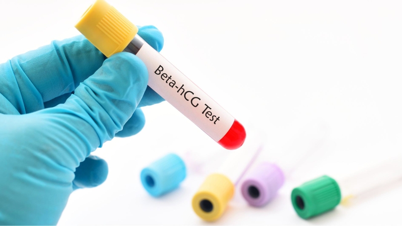 Xét nghiệm máu beta-hCG là phương pháp chính xác và đáng tin cậy nhất để xác định có thai