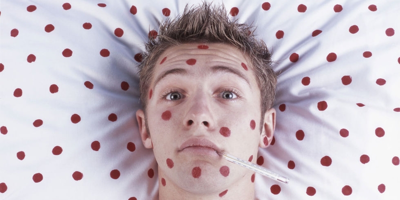 Dấu hiệu các nốt sởi và phân biệt với sốt phát ban 2