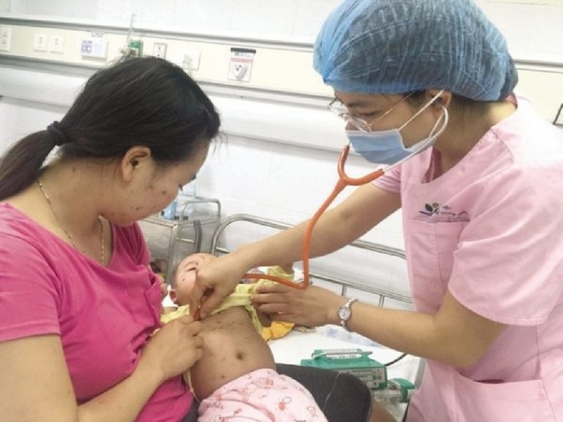 Những dấu hiệu của bệnh sởi ở trẻ sơ sinh mà mẹ cần nắm vững 3