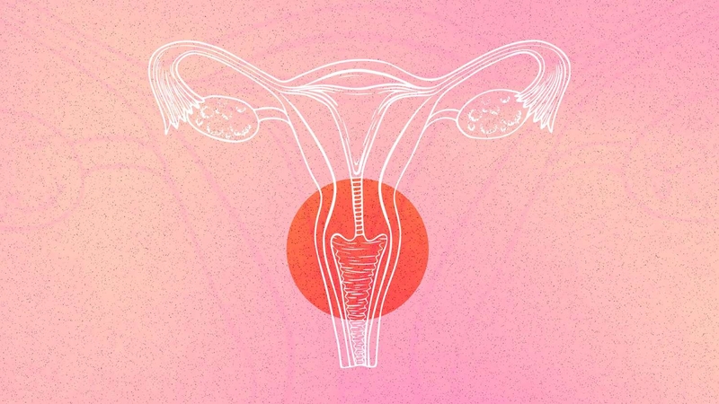 Dấu hiệu của ung thư cổ tử cung giai đoạn đầu mà phụ nữ cần nhận biết 1