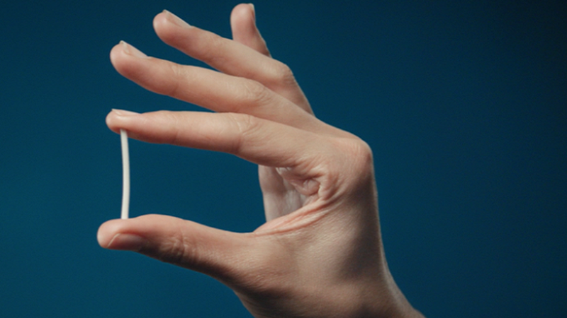 Dấu hiệu dị ứng que cấy tránh thai và cách phòng ngừa 1