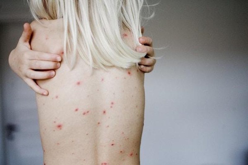 Giai đoạn đầu của bệnh giang mai bắt đầu&nbsp;khoảng 3-4&nbsp;tuần