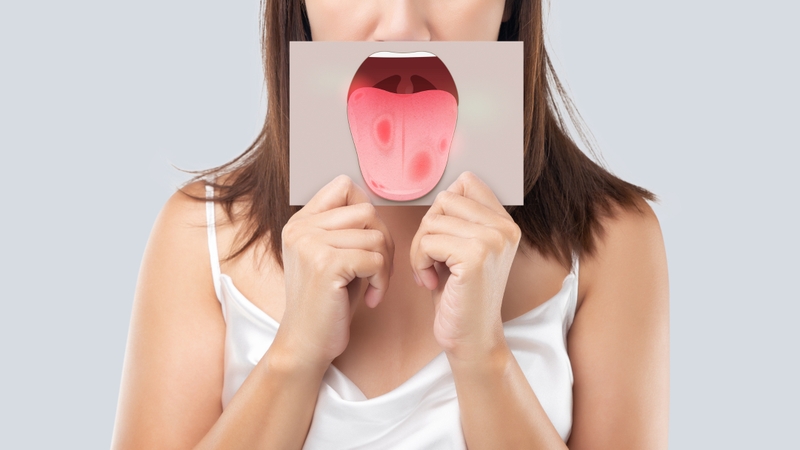 Dấu hiệu, hình ảnh ung thư lưỡi giai đoạn cuối dễ nhận biết 2