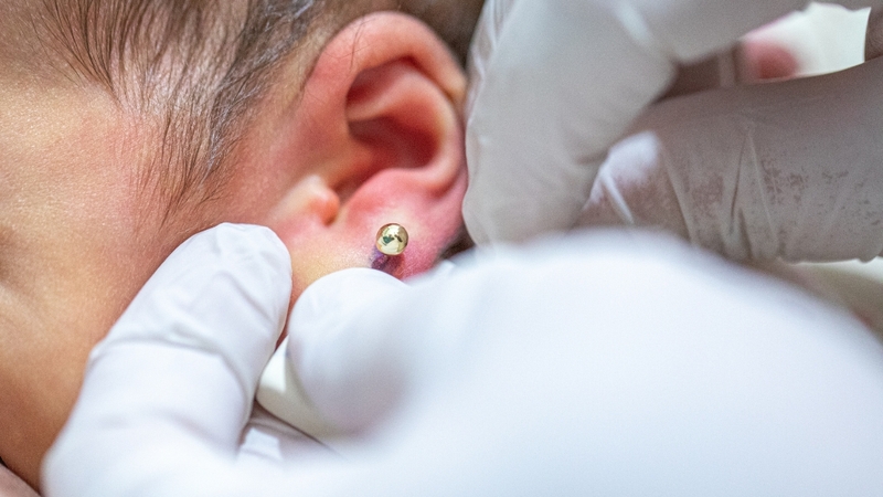 Nên đi khám nếu lỗ xỏ sưng đau tăng, có mủ, sốt hoặc lâu không hồi phục