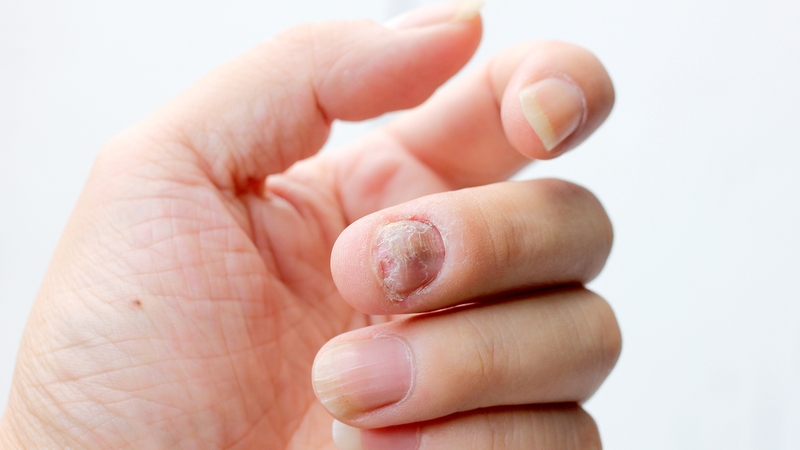 Nên đi khám nếu các dấu hiệu bất thường kéo dài và không cải thiện