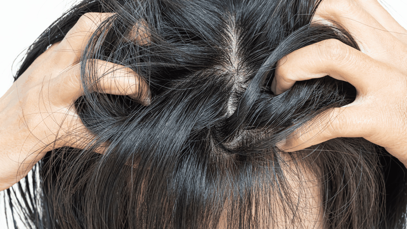 Môi trường ẩm ướt khiến da đầu xuất hiện bệnh nấm da đầu