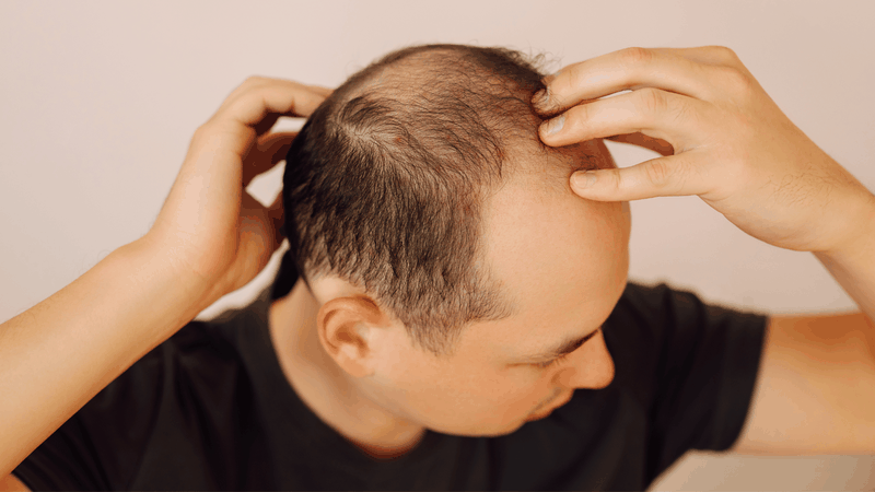 Khi cảm nhận dấu hiệu da đầu bị ngứa, rụng tóc bất thường, nổi mụn, đừng chủ quan mà hãy tìm đến bác sĩ để ngăn ngừa bệnh nấm da đầu