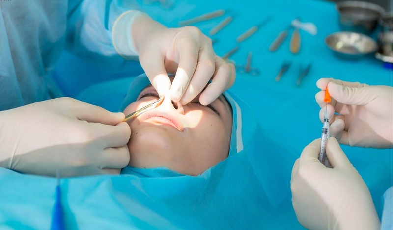Dấu hiệu nâng mũi bị lệch vách ngăn và có khắc phục được không? 2