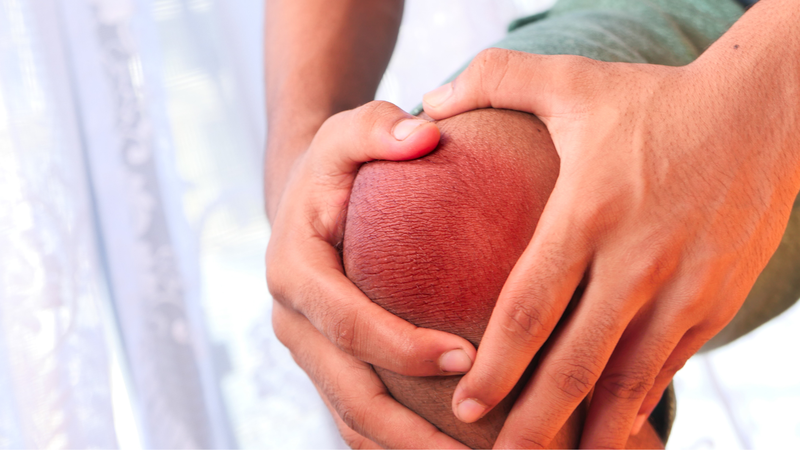 Dấu hiệu nhận biết bong điểm bám dây chằng chéo trước 1