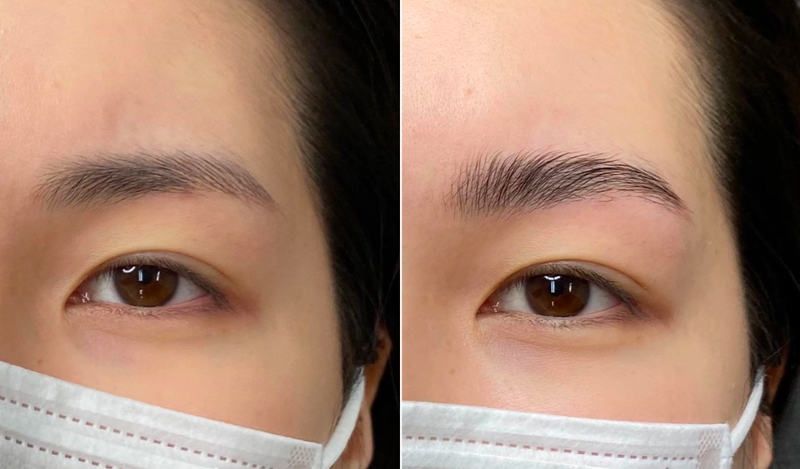 Dấu hiệu nhận biết có thai qua khuôn mặt: lông mày dựng