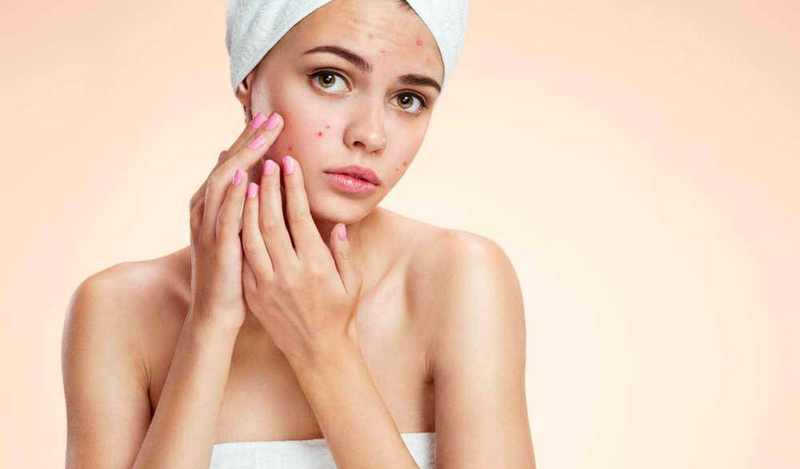 Dấu hiệu nhận biết có thai qua khuôn mặt: da mặt xấu, nổi mụn