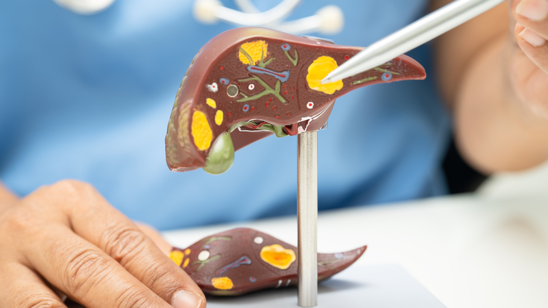 Khám chức năng gan định kỳ giúp phát hiện sớm rối loạn chuyển hóa và tổn thương gan tiềm ẩn