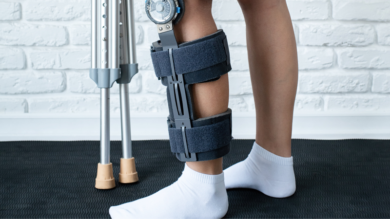 Dấu hiệu nhận biết gãy xương cẳng chân bạn nên biết 2