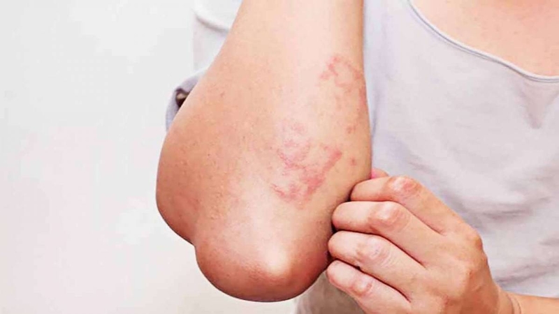 Ô nhiễm thực phẩm do ký sinh trùng gây bệnh nhiễm giun sán