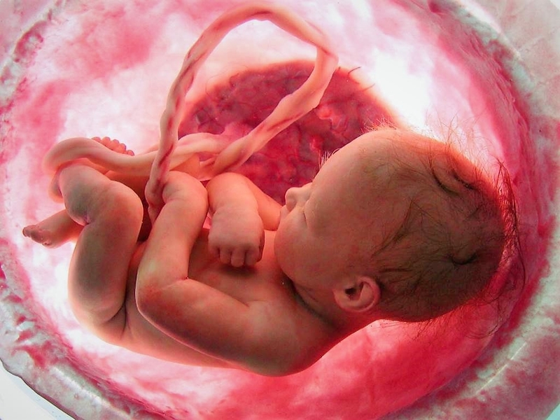 Dấu hiệu nhận biết ngôi thai thuận tuần 32 là gì? Những lưu ý cần biết  2