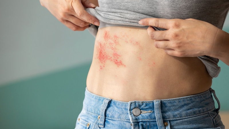 HIV hoàn toàn có thể phát hiện sau 3 năm phơi nhiễm