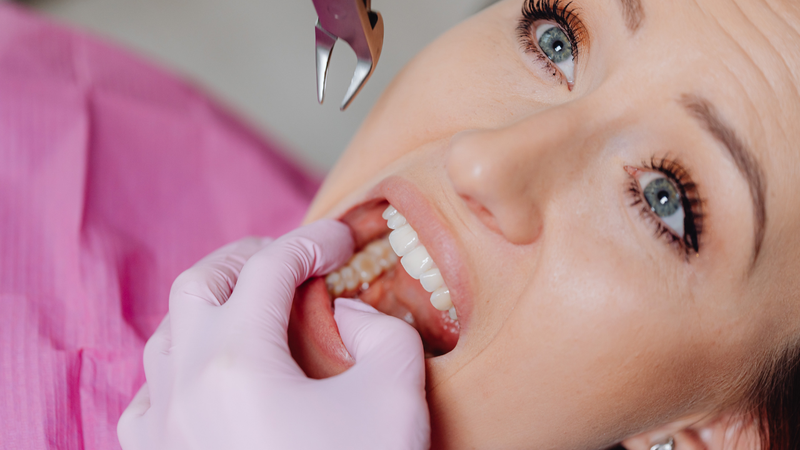 Tay nghề và kinh nghiệm của nha sĩ đóng vai trò rất quan trọng