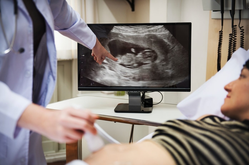 Dấu hiệu thai 10 tuần khỏe mạnh,​ phát triển tốt - 2