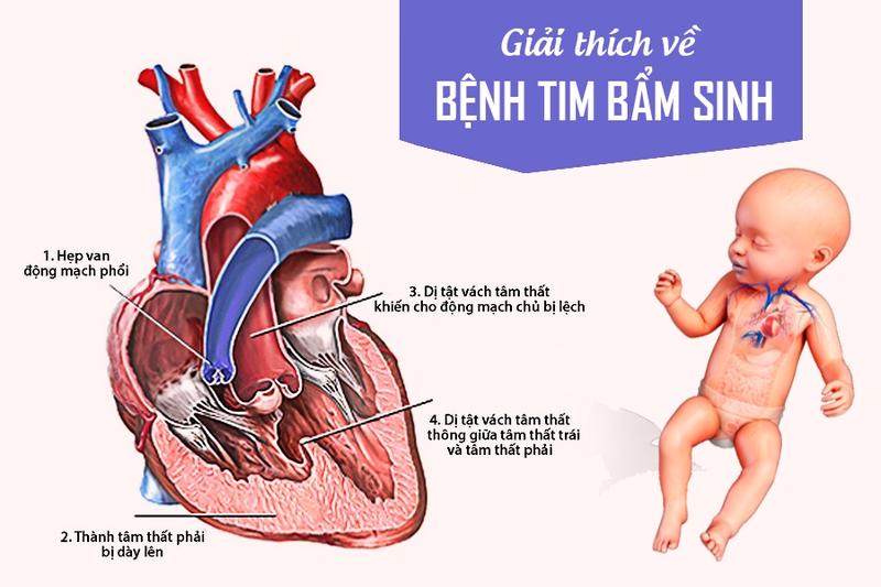 Dấu hiệu thai nhi bị dị tật - Làm sao để phát hiện? 2