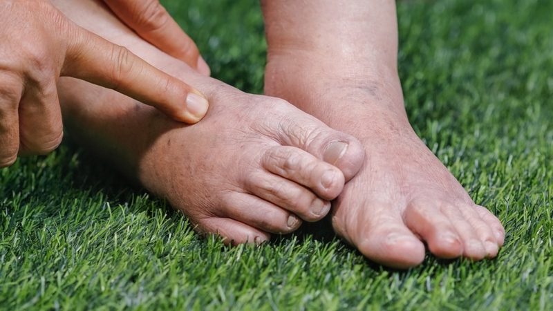 Dấu hiệu thận yếu: Nhận biết sớm để bảo vệ sức khỏe thận hiệu quả 1