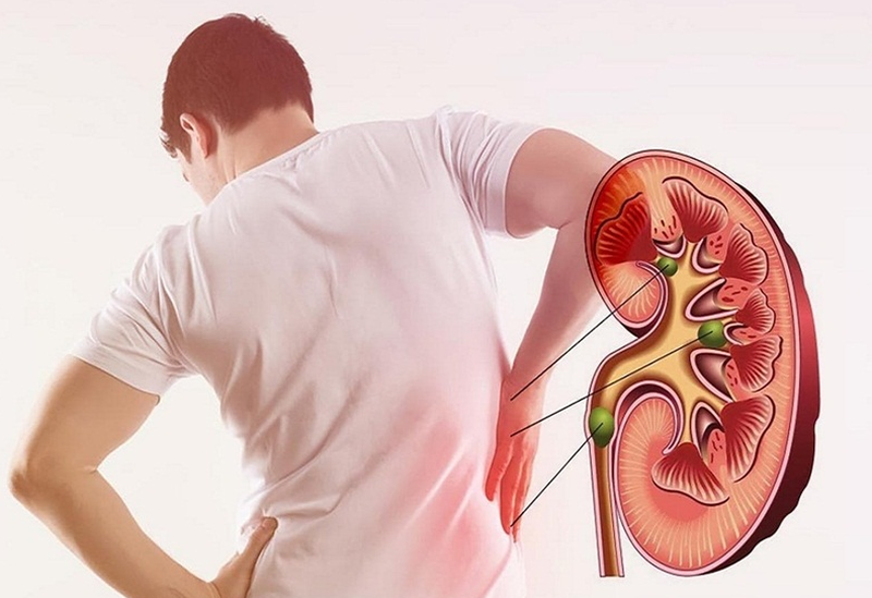 Dấu hiệu thận yếu ở nam giới và những nguyên nhân gây bệnh cần biết 1