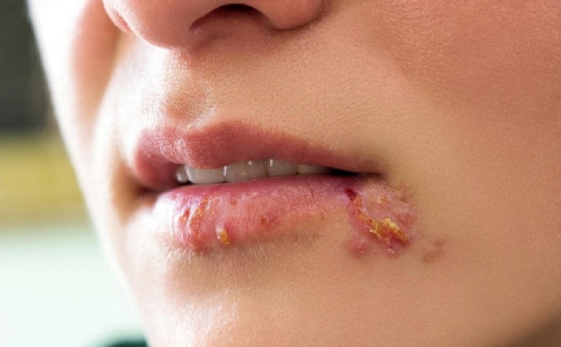 Dấu hiệu thiếu chất dinh dưỡng nào mà bạn cần nắm vững 2