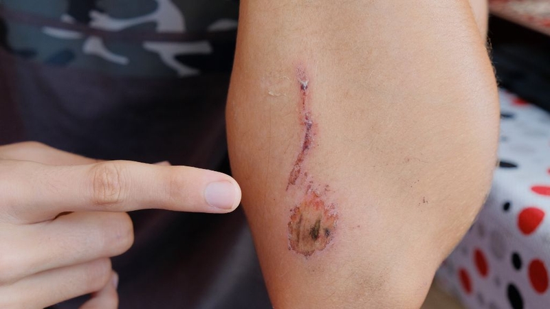 Dấu hiệu thiếu vitamin C và bổ sung sao cho khoa học? 1