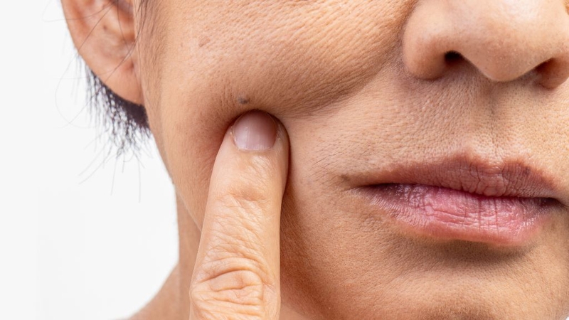 Dấu hiệu thiếu vitamin C và bổ sung sao cho khoa học? 2