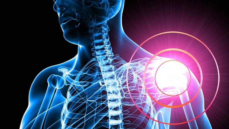 Trật khớp vai là một chấn thương thường gặp trong hệ vận động, xảy ra khi chỏm xương cánh tay bị trượt ra khỏi ổ chảo của xương vai