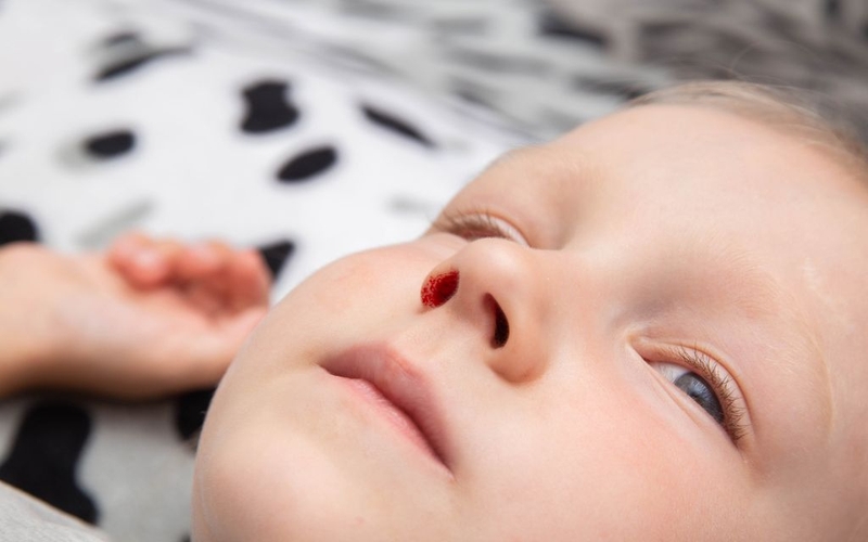 Dấu hiệu trẻ thiếu hụt vitamin C là gì? Hướng dẫn cách bổ sung vitamin C cho trẻ 4 tuổi 2