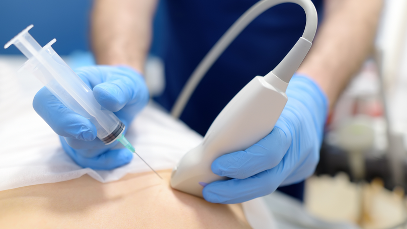 Bác sĩ sẽ lấy một mẩu mô nhỏ từ khối u nghi ngờ