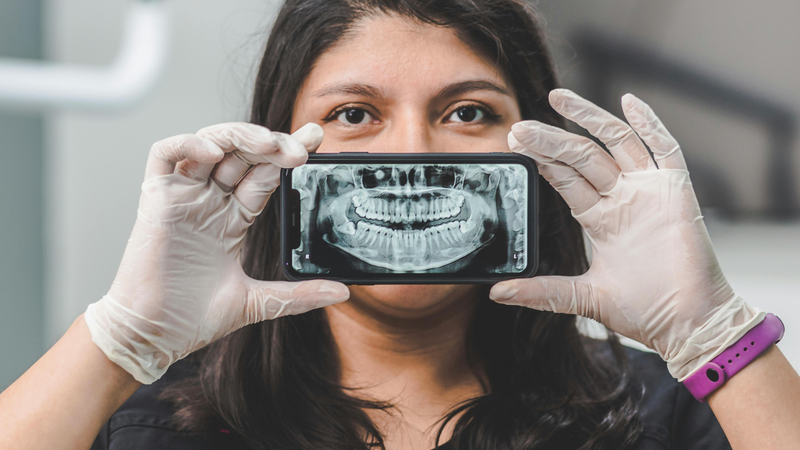 Chụp X-quang là bước cơ bản để quan sát tổng quan xương hàm