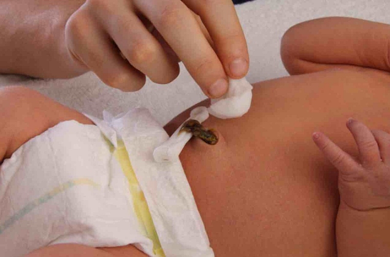 Dấu hiệu uốn ván rốn ở trẻ sơ sinh là gì1