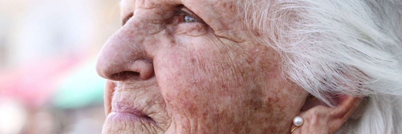 Dấu hiệu và cách điều trị đồi mồi trên da hiệu quả1