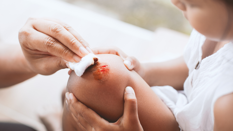 Dấu hiệu và cách phòng ngừa hoại tử khô: Hiểu để bảo vệ sức khỏe 2