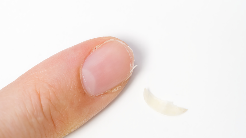 Da khô, tóc và móng dễ gãy có thể là dấu hiệu cho thấy cơ thể đang thiếu canxi