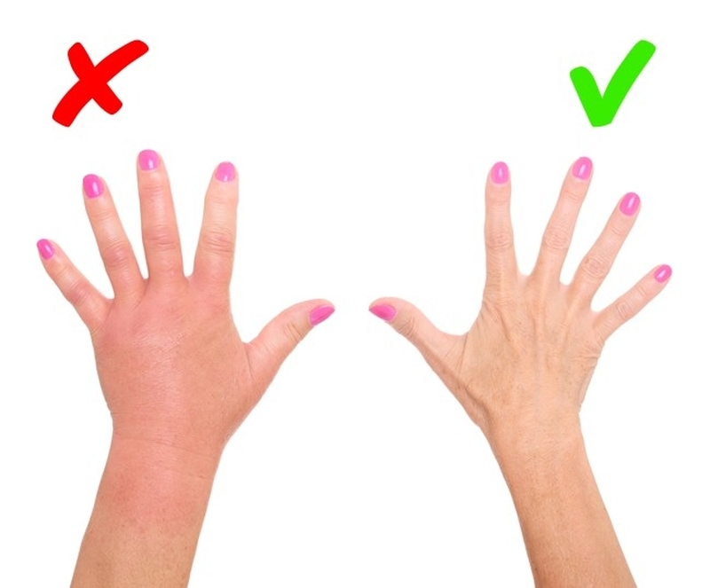 8 dấu hiệu về da cảnh báo những mối nguy hại cho sức khỏe 2 8 dấu hiệu về da cảnh báo những mối nguy hại cho sức khỏe 2