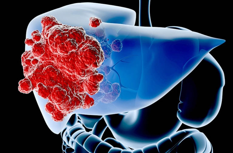 Dấu hiệu viêm gan D và hướng điều trị không phải ai cũng biết 1