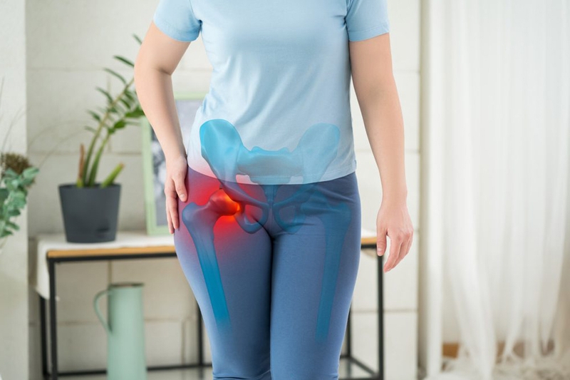 Đau hông phải là bệnh gì? Khi nào nên đến gặp bác sĩ?