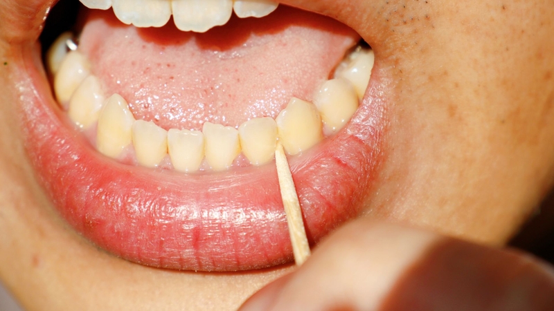 Đau kẽ chân răng là cảm giác đau xuất hiện ở vùng tiếp giáp giữa hai răng