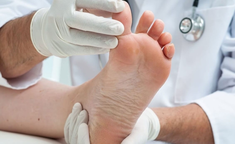 Đau khớp bàn tay trái là biểu hiện bệnh gì?2