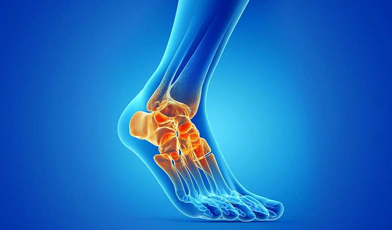 Thoái hóa khớp cổ chân thường diễn ra chậm với những biểu hiện ban đầu khá mơ hồ