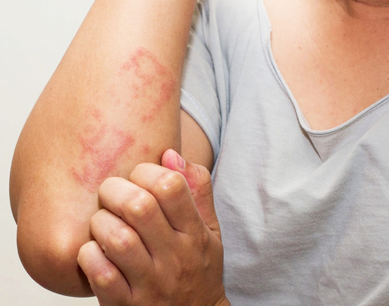 Đau khớp gối HIV phải làm gì? 1